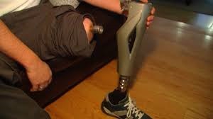 Amputated leg regrows